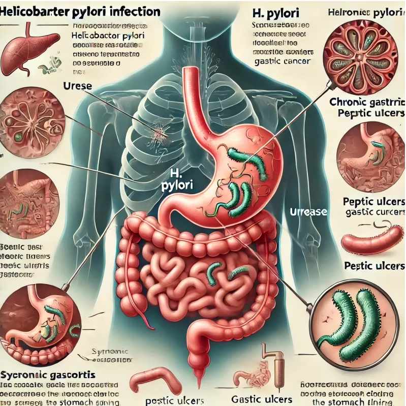 H. Pylori -testaus tehtiin yksinkertainen: Ratkaisusi nopeaan ja luotettavaan diagnoosiin
